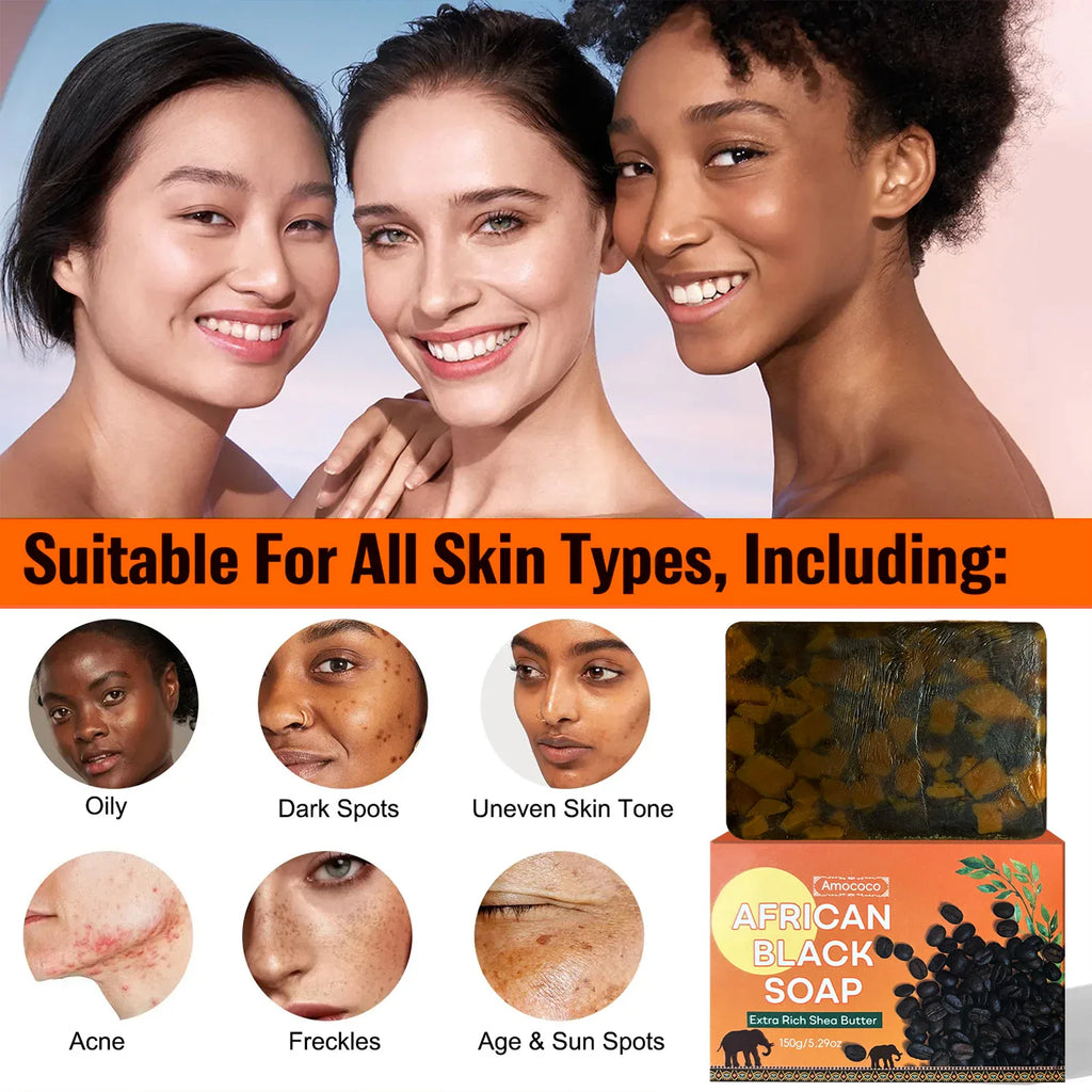 Collage of different skin types and issues next to a bar of African black soap and its packaging