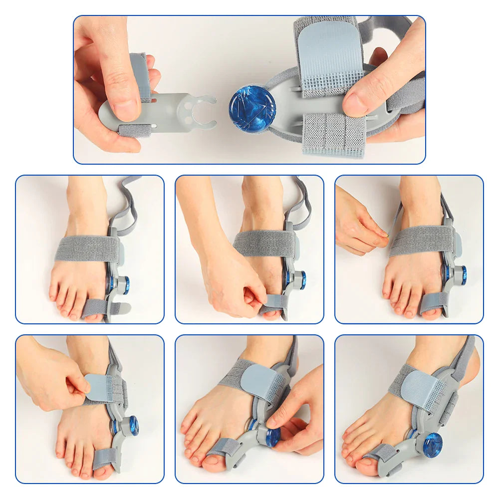 Step-by-step assembly and fitting instructions for a bunion correction foot brace
