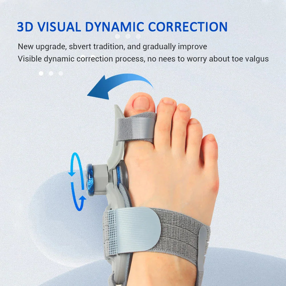 Foot wearing a grey hallux valgus toe separator and bunion alignment brace